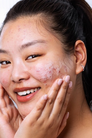 Schuimende Gel Sebiaclear Geschikt voor elk huidtype - 200 ml