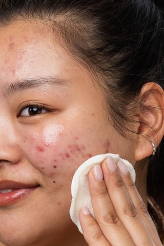 Micellair Water Sebiaclear Geschikt voor elk huidtype - 400 ml