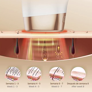 Épilateur à lumière pulsée - Corps - Blanc