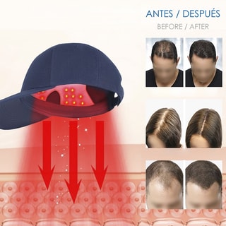 Ledpet tegen haaruitval - Blauw