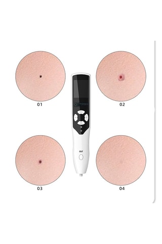 Stylo multifonction à ozone - 5 têtes