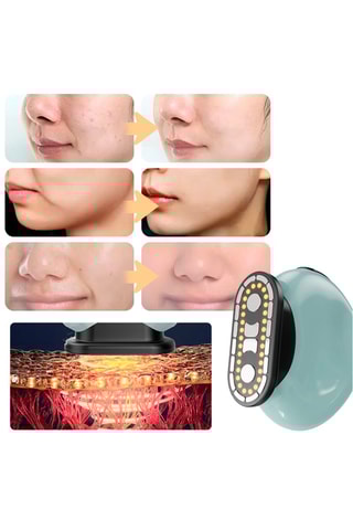 Apparecchio bellezza antietà