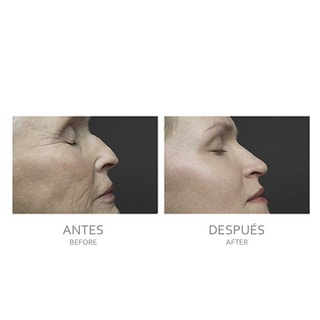 Appareil de soin de la peau 4-en-1 - Visage