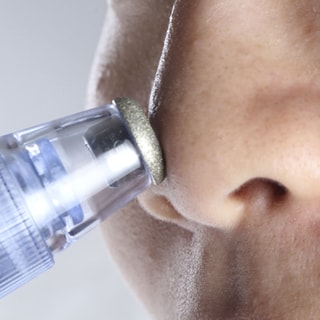 Aspirateur de points noirs - Visage