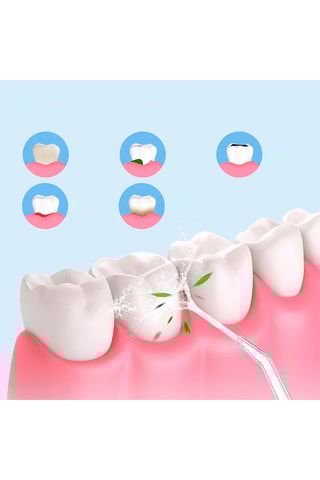 Irrigateur buccal - 3 modes d'utilisation
