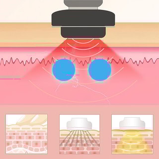 Appareil de massage myoélectrique - Visage