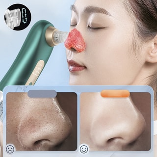 Aspirateur de points noirs - Blanc