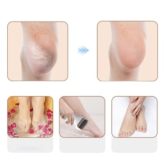 Râpe électrique exfoliante - Pieds