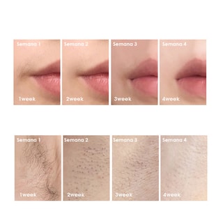 Épilateur à lumière pulsée - Corps - Vert