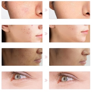 Masque LED photonique - 7 couleurs - Anti-âge - Visage