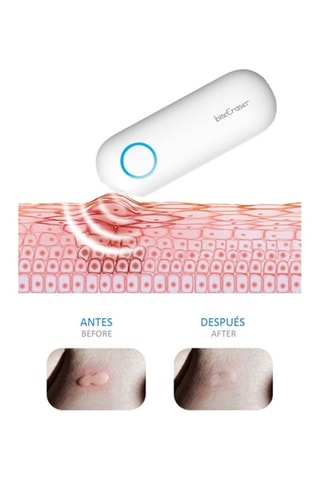 Appareil de traitement des piqures d'insectes