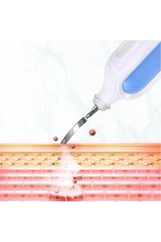 Instrument de beauté à vibration - Nettoyage de pores