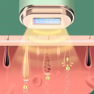 Épilateur lumière pulsée - T61 IPL - Corps - Vert