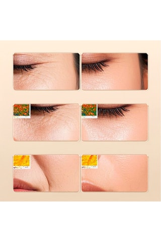 Appareil de massage facial