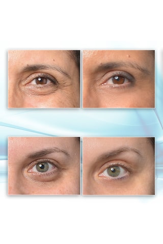 Gel contorno de ojos - 30 ml