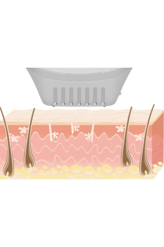 Epilatore a luce pulsata