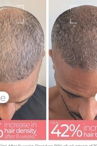 Ledtherapieborstel Rood - Haar