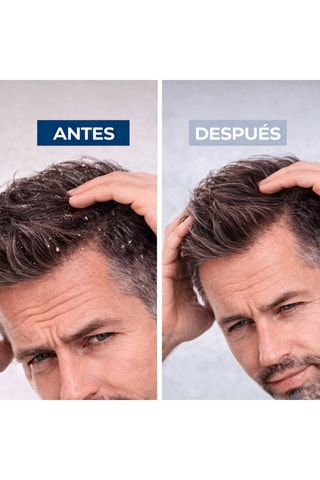 Antiroosshampoo - 1000 ml