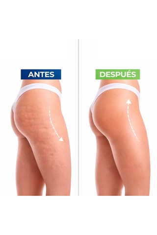 Verstevigende crème - Geschikt voor elk huidtype - 1 l