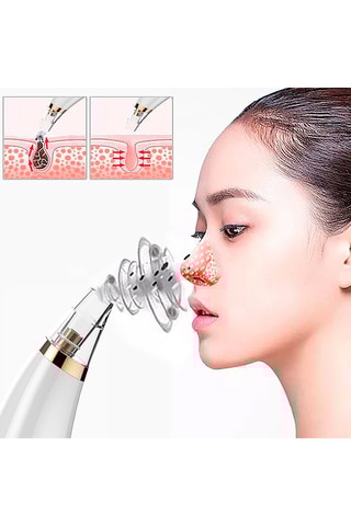 Extrator de pontos negros X1 - 3 cabeças