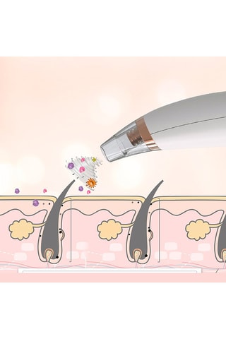 Extrator de pontos negros X4 Branco