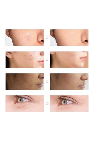 Máscara facial LED - Branco