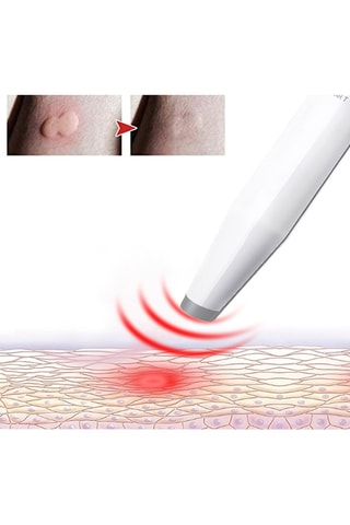 Dispositivo eletrónico contra a comichão de picadas de insetos