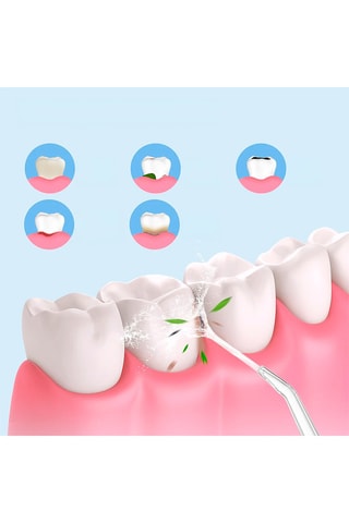 Irrigador oral - 3 modos de massagem