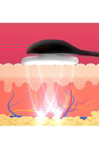 Aparelho EMS de eletroestimulação facial 105D