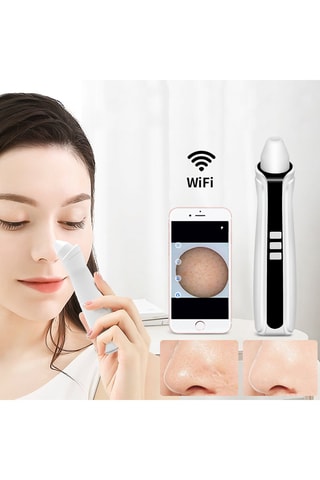 Aspirador de pontos negros Branco