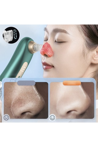 Aspirador de pontos negros - Branco