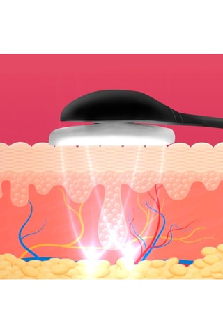 Aparelho de eletroestimulação facial EMS