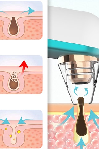 Extrator de pontos negros X9 escuro