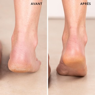 Balsamo multiuso vegan Hero All-purpose Balm - 40 ml