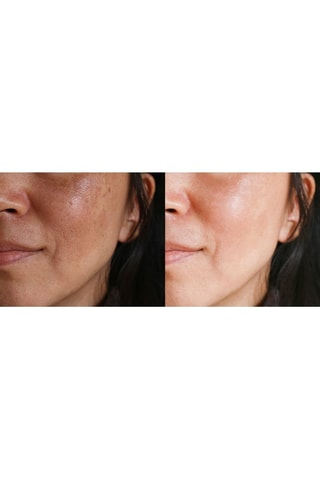 Aparato de limpieza facial
