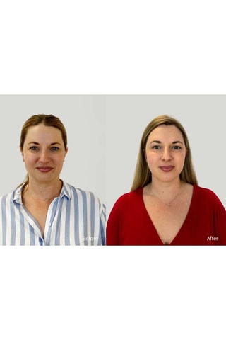 Dispositivo de spa facial BEAR™ mini - Rosa claro