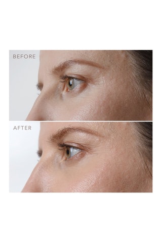 Sérum reafirmante para ojos Iris™ - 15 ml