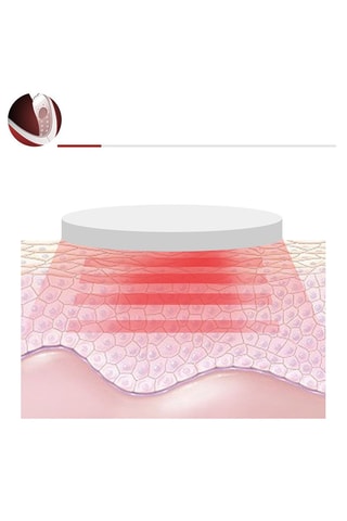 Ceinture faciale à électrostimulation - Rouge