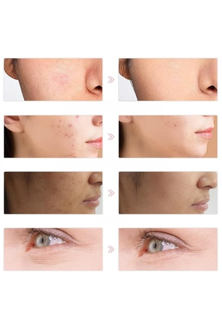 Máscara facial LED - Branco