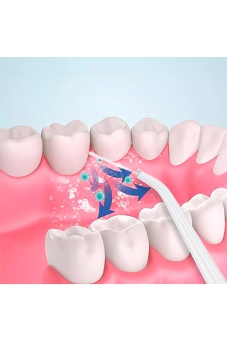 Irrigateur buccal - 3 modes d'utilisation