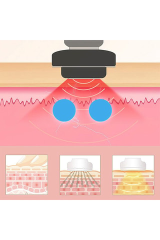 Appareil de massage myoélectrique - Visage