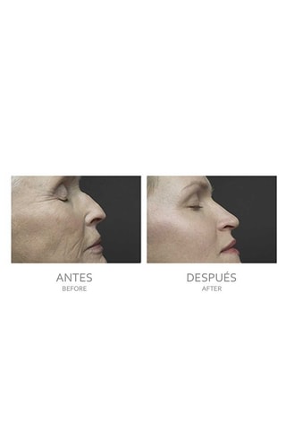Appareil de soin de la peau 4-en-1 - Visage