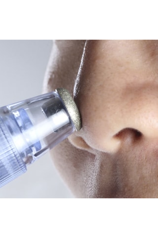 Aspirateur de points noirs - Visage
