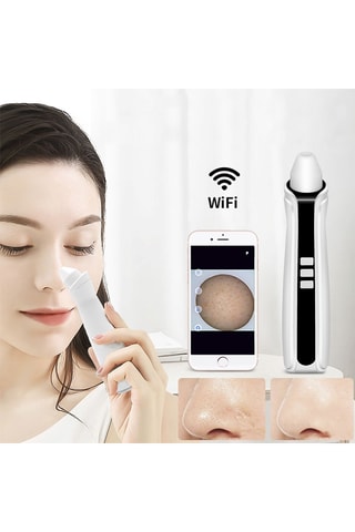 Aspirateur de points noirs - Visage