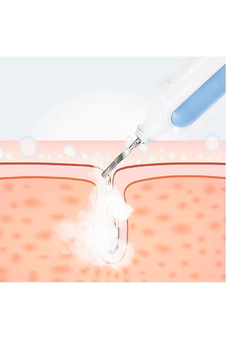 Instrument de beauté à vibration - Nettoyage de pores