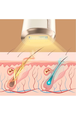 Epilateur laser électrique - Rose