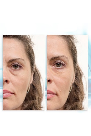 Gel contorno de ojos - 30 ml