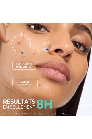 Pâte concentrée anti-boutons Mixa - Peaux sensibles - 15 ml