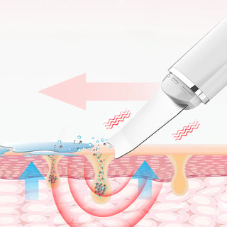 Massaggiatore viso ad ultrasuoni - Nero